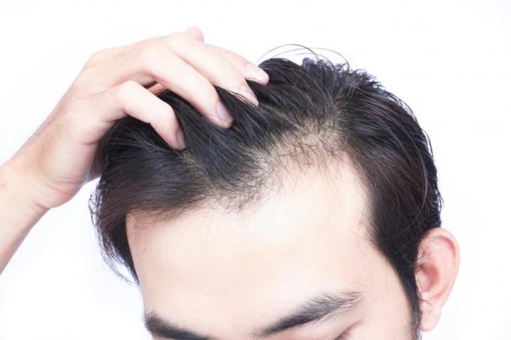 hair loss is a skin problem